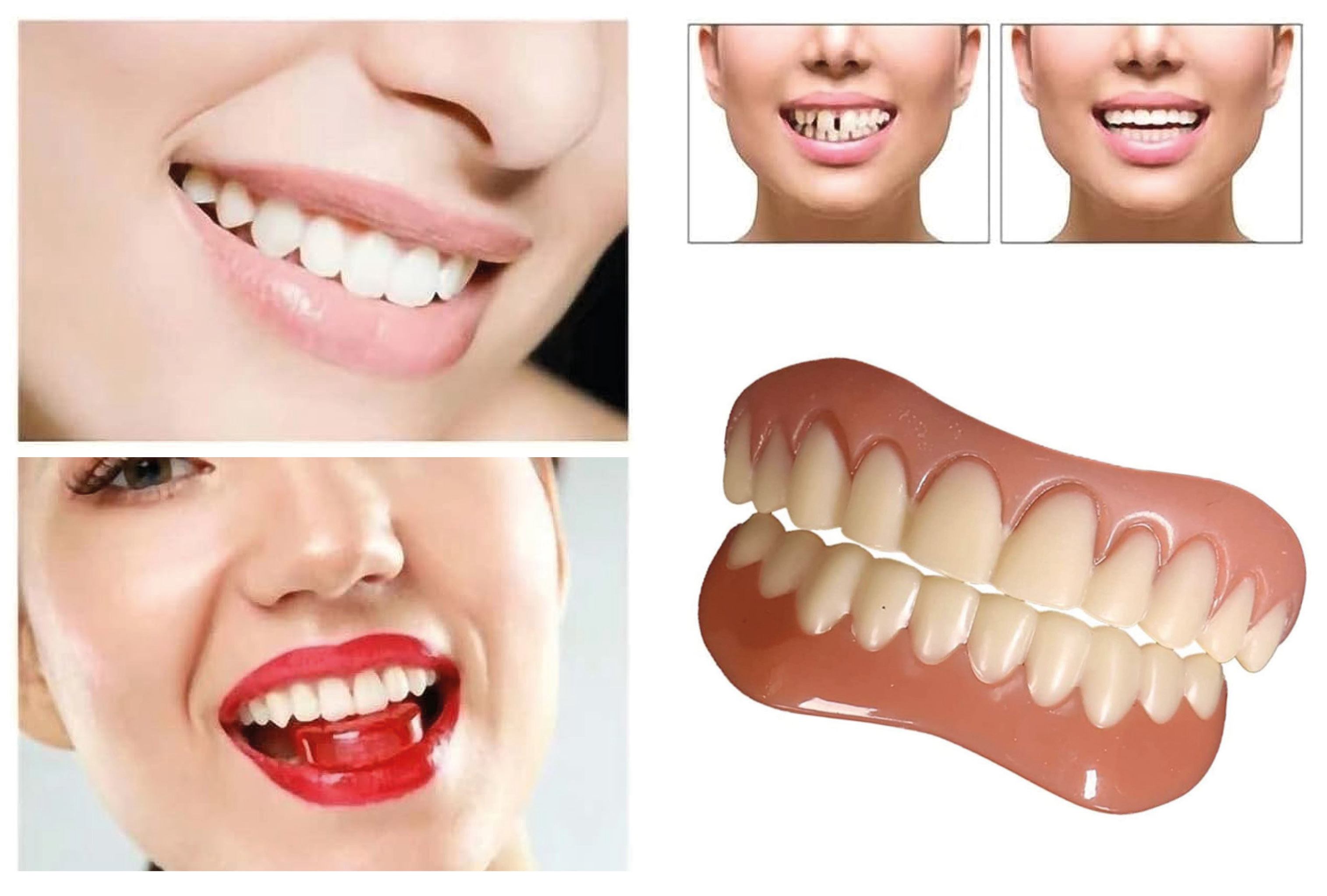 užitočná dočasná snímateľná zubná náhrada vrchná a spodná